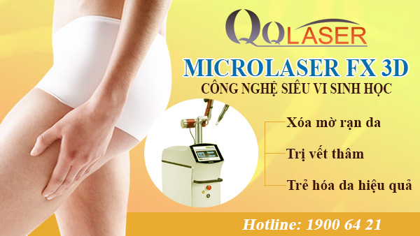 cong nghe MicroLaser FX