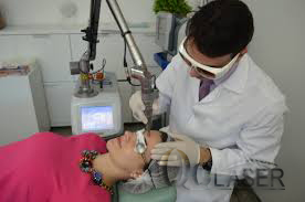 Cong nghẹ laser spectra Toning