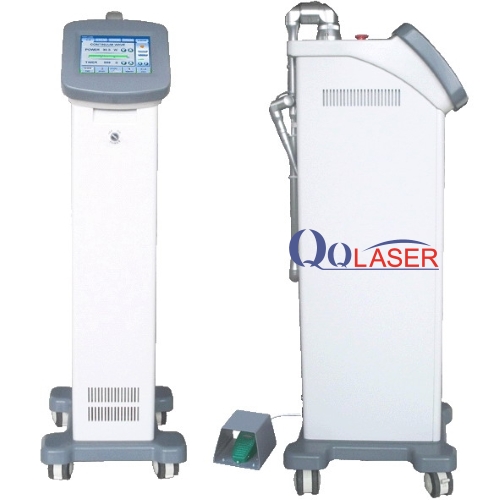 công nghệ laser q switched nd yag